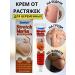 lati Except from stretch marks for pregnant women