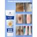 Dodoyuri whitening cream for an intimate zone 20 ml - Buy Online on GoSupps.com