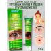 New suite Eye cream from dark circles and edema