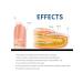Eelhoe fungus of gray nail thickenation restoration manual - Buy Online on GoSupps.com