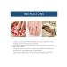 Eelhoe fungus of a gray nail thickening restoration manual ... - Buy Online on GoSupps.com