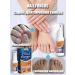 Nail Fungus spray from nail fungus on the legs of onychomycosis 30 ml