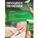 No Complaints health Remedy for nail fungus on the legs 1 pc - Buy Online on GoSupps.com