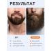 DRSKINVITA Oil for caring for laying a beard of mustache mitigating 30 ml - Buy Online on GoSupps.com
