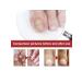Ximonth Treatment of fungal infections of care of nail care solution - Buy Online on GoSupps.com