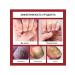 Restorative nails Protective patch Eliminate fungi - Buy Online on GoSupps.com