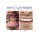 Toothpaste whitening with a probiotic - Buy Online on GoSupps.com