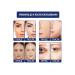JaySuing Eye collagen repair gel entity against wrinkles Regeneration - Buy Online on GoSupps.com