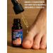 muva Oil from ingrown nails of the legs therapeutic - Buy Online on GoSupps.com