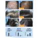 LYDIMOON Shampoo from dandruff removes the itching of the scalp 300 ml - Buy Online on GoSupps.com