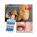 2*20 g of ointments from nail fungus to eliminate inflammation