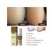 South Moon Antosplay for Feet fungus Spray - Buy Online on GoSupps.com