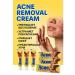 Moneymore Facial cream from acne