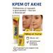 SBB Acne cream rashes and acne 3 pcs