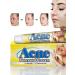 zoomba Acne cream 3 pieces - Buy Online on GoSupps.com