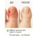 DDE intensive A remedy for an ingrown nail 5pcs - Buy Online on GoSupps.com