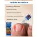 BIRKAZHY Remedy and care of ingrown nails - Buy Online on GoSupps.com