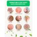 NazzHome Chinese ointment from psoriasis dermatitis and acne - Buy Online on GoSupps.com