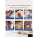 Spray for the treatment of skin diseases of dogs - Buy Online on GoSupps.com