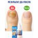 OLBY Drops from nail fungus on the legs Effective treatment 3 pcs - Buy Online on GoSupps.com