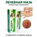 Chinese Simufin creams Eczema and dermatitis cream