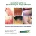 Itching cream is relieved of bacterial infections 20 g - Buy Online on GoSupps.com