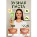 GKM1 Antibacterial and whitening toothpaste