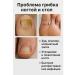 Therapeutic ointment from the fungus between the fingers - Buy Online on GoSupps.com