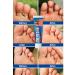 Therapeutic ointment from the fungus between the fingers - Buy Online on GoSupps.com