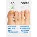 Therapeutic ointment from the fungus between the fingers - Buy Online on GoSupps.com