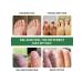 KazBrand Nail fungus cream ointment to remove fungus on nails - Buy Online on GoSupps.com