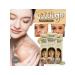 MaxWish 09 Cream for removing freckles and pigment spots of vitiligo 3pcs