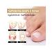 Repair essence for treats ingrown nails and fungal infections - Buy Online on GoSupps.com