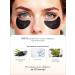 Sadoer Eye Patches Paths for the eyes from edema and bags with collagen - Buy Online on GoSupps.com