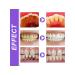Eelhoe lysozyme toothpaste for tooth a violet 3 pcs - Buy Online on GoSupps.com