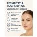 THEON Paths from wrinkles on the forehead against facial mimic folds 5 units - Buy Online on GoSupps.com