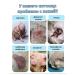 Spray from cutting lichen for dogs and cats 100 ml - Buy Online on GoSupps.com