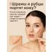 Asya Mir Gel from scars - Buy Online on GoSupps.com