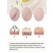 Cream gel from scars and scars of a post-acne burns on the face and body - Buy Online on GoSupps.com