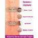 Cream gel from scars and scars of a post-acne burns on the face and body - Buy Online on GoSupps.com