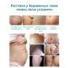 Cream gel from scars and scars of a post-acne burns on the face and body - Buy Online on GoSupps.com