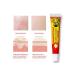 Ointment from psoriasis eczema atopic dermatitis - Buy Online on GoSupps.com