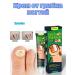 KEVO Miracle cream from nail fungus