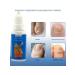 MaxWish 09 Antibacterial fluid for the treatment of ingrown nails 3 pcs - Buy Online on GoSupps.com