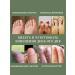Barynch MAZOT Nail fungus antifungol with nail fungus onycholysis - Buy Online on GoSupps.com