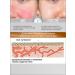 Algomask Alginate face mask Anti -kuperous lifting - Buy Online on GoSupps.com