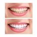 VIAN Toothpaste whitening concentrated on herbs 25 g - Buy Online on GoSupps.com