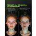 Shi Fei Shi Miracle ointment from acne on the body anti -inflammatory 35 g - Buy Online on GoSupps.com