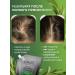 KeraSys Therapeutic shampoo from dandruff - Buy Online on GoSupps.com
