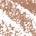 0.001 / 0.04 Shade 3 - warm light brown